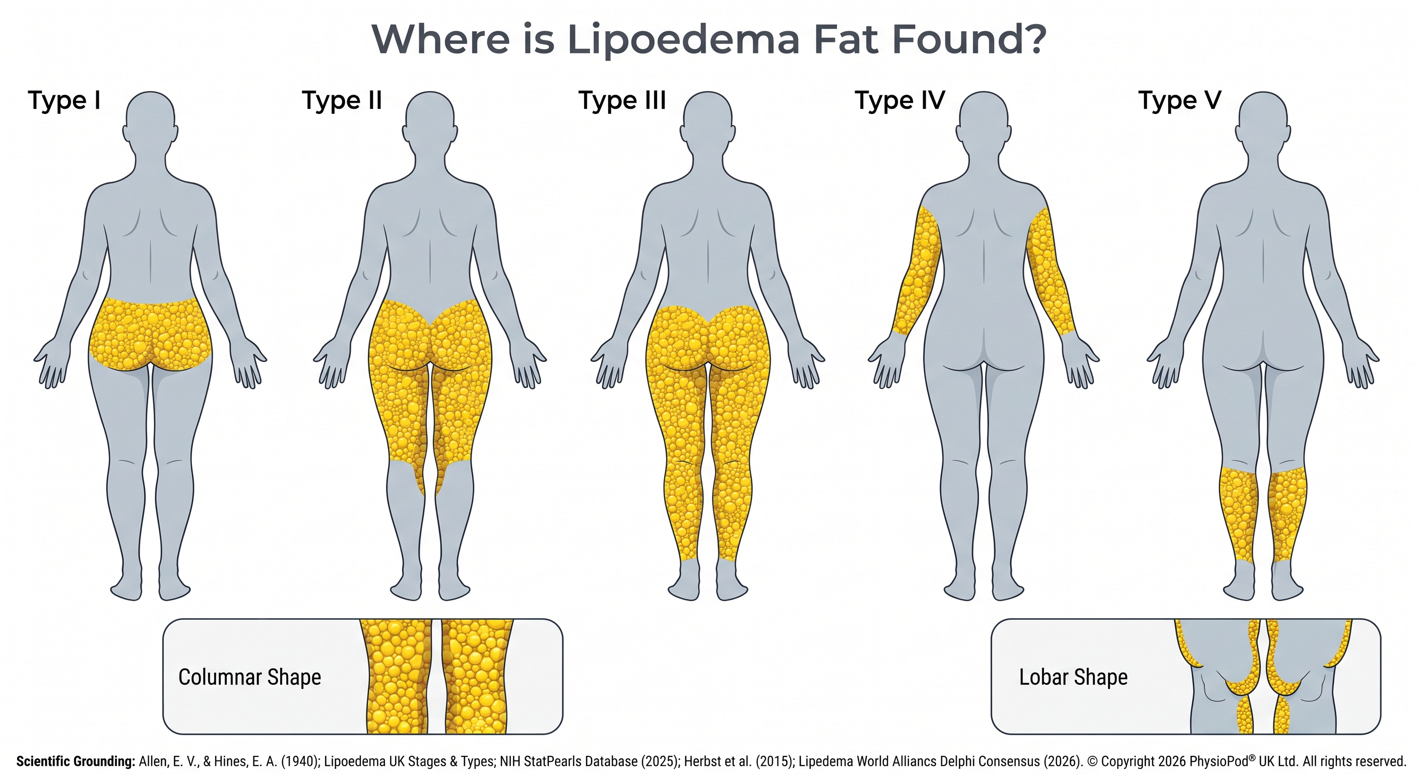 where is lipoedema fat found